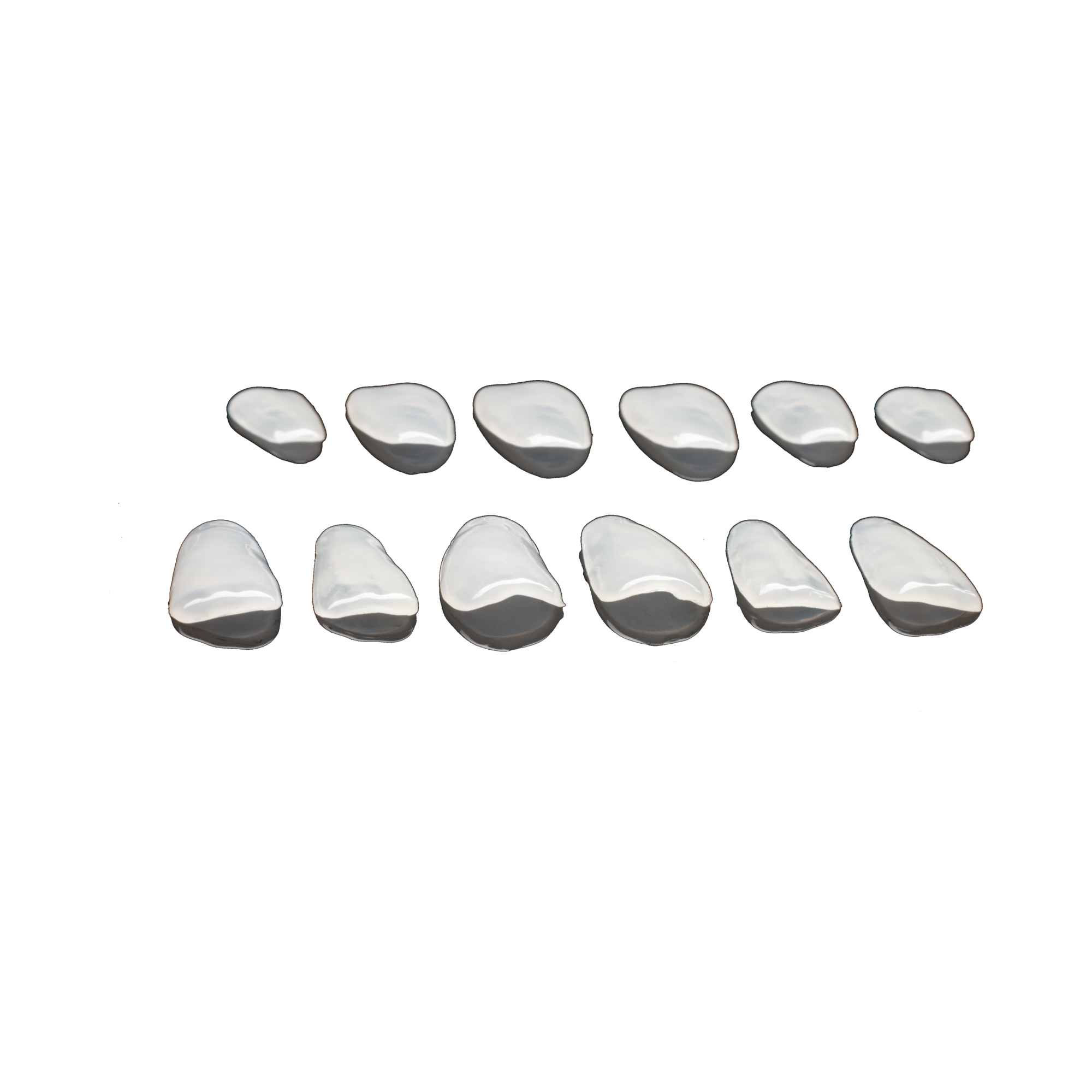 edelweiss Dentistry Veneer Welcome Set M: 1 Veneer Case Set 13-23 M up, 1 Veneer Bond, 10 Composite compules, Sizing Guides, Shade Guide Sticks, Instructions for use