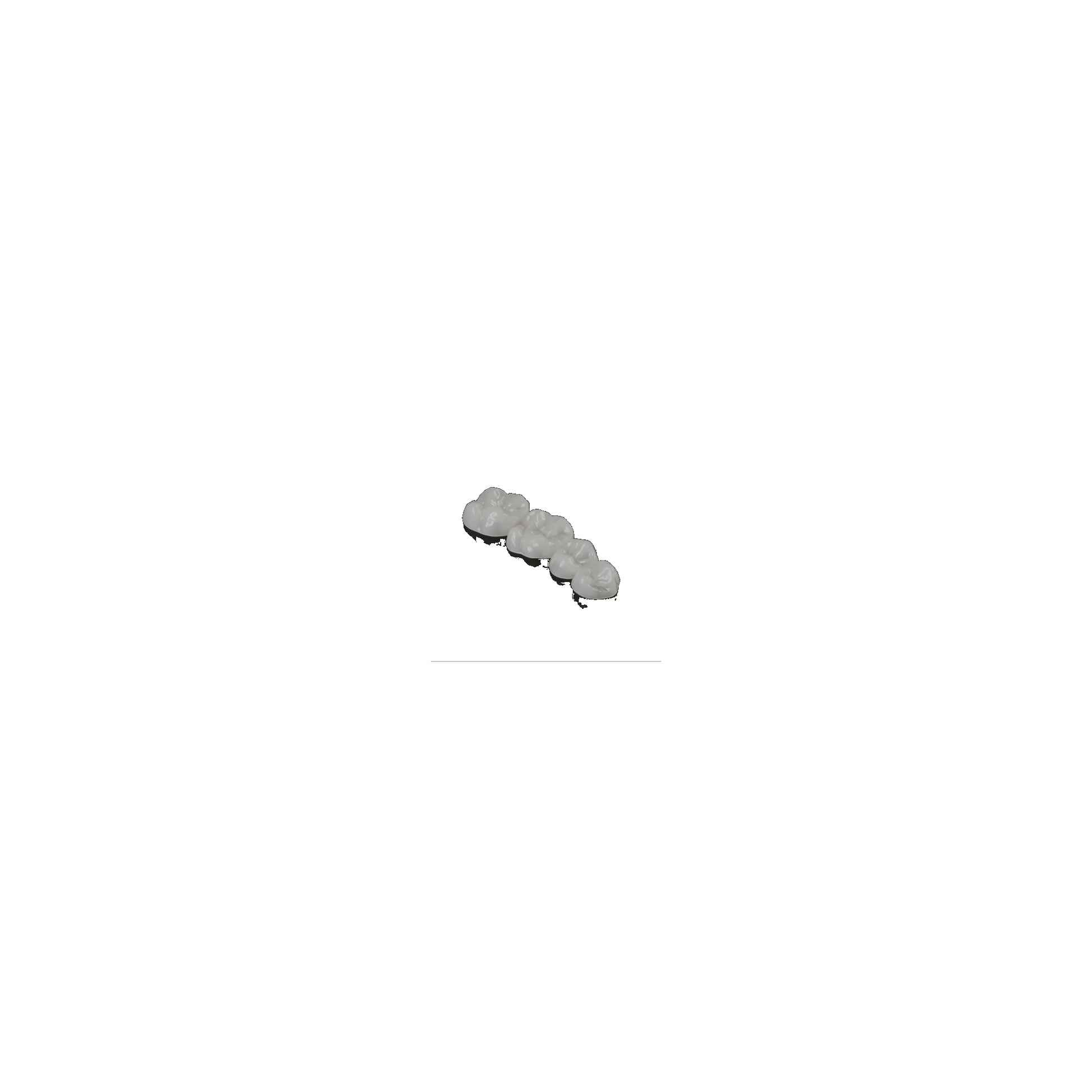 edelweiss Dentistry 4 OcclusionVD Refill Set: 17-14 Large Upper (1x 17, 16, 15, 14 L)