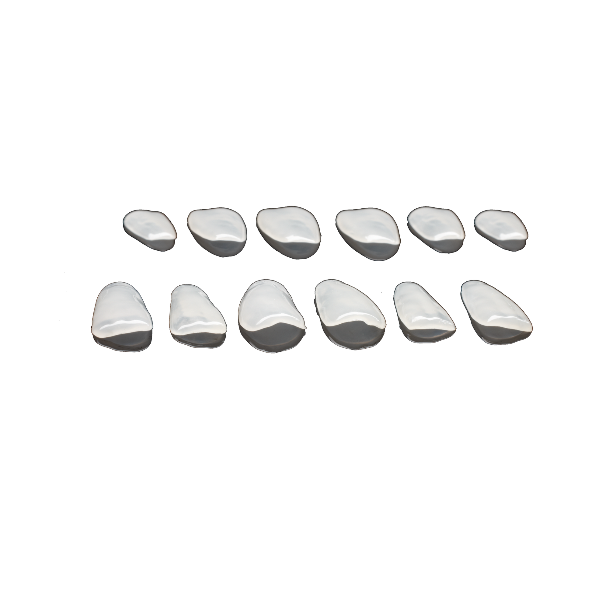 edelweiss Dentistry Single Veneer