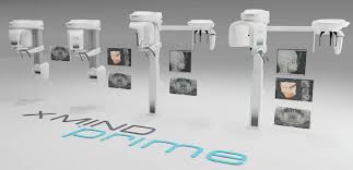 X-Mind™ Prime Ceph