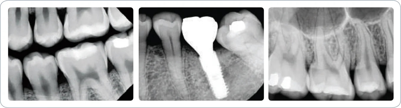 Vatech EzRay Premium